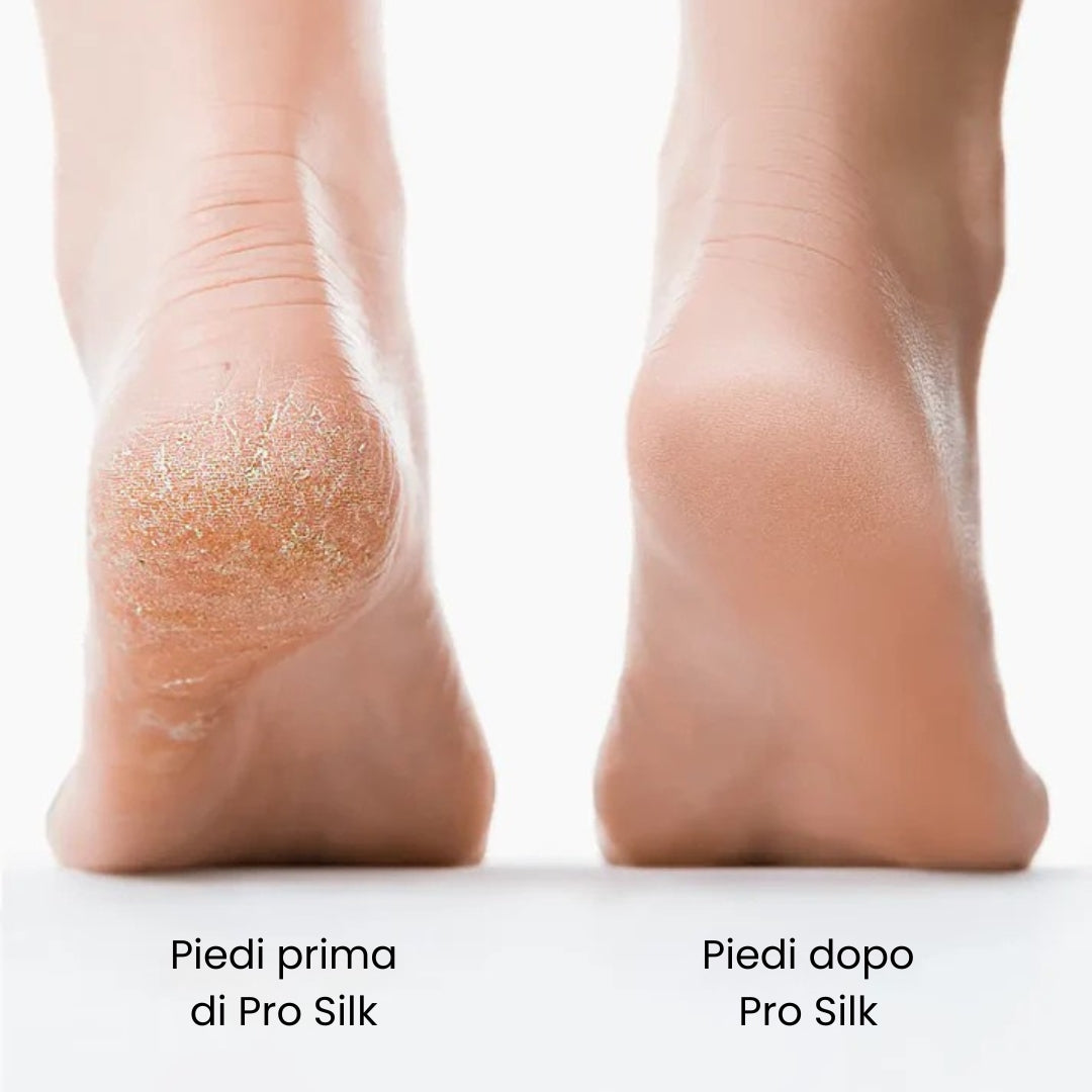 Pro Silk – Rimuovi Calli Elettrico Professionale